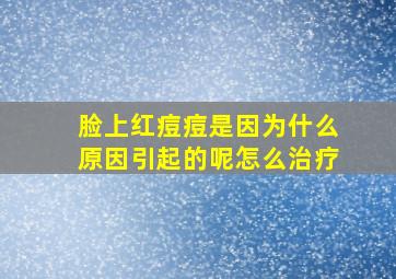 脸上红痘痘是因为什么原因引起的呢怎么治疗