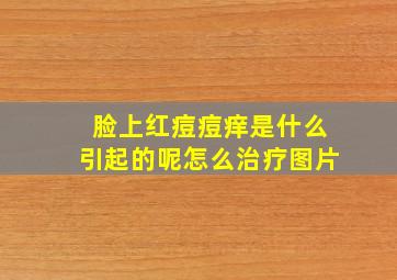 脸上红痘痘痒是什么引起的呢怎么治疗图片