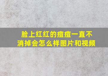 脸上红红的痘痘一直不消掉会怎么样图片和视频