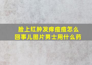 脸上红肿发痒痘痘怎么回事儿图片男士用什么药