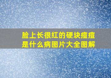 脸上长很红的硬块痘痘是什么病图片大全图解