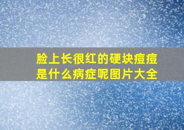 脸上长很红的硬块痘痘是什么病症呢图片大全