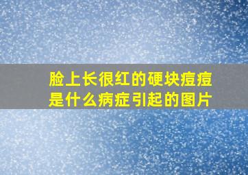 脸上长很红的硬块痘痘是什么病症引起的图片