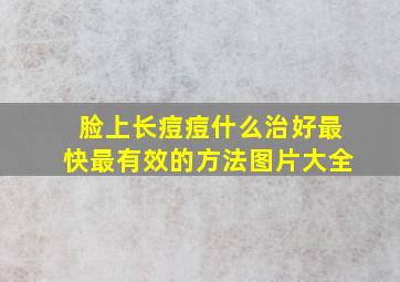 脸上长痘痘什么治好最快最有效的方法图片大全