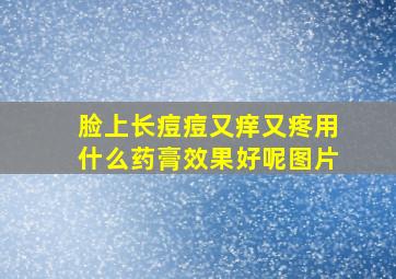 脸上长痘痘又痒又疼用什么药膏效果好呢图片