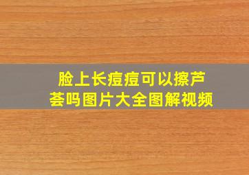 脸上长痘痘可以擦芦荟吗图片大全图解视频