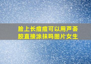 脸上长痘痘可以用芦荟胶直接涂抹吗图片女生