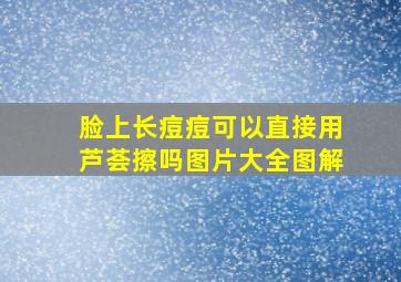 脸上长痘痘可以直接用芦荟擦吗图片大全图解