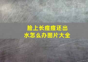 脸上长痘痘还出水怎么办图片大全