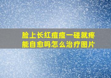 脸上长红痘痘一碰就疼能自愈吗怎么治疗图片