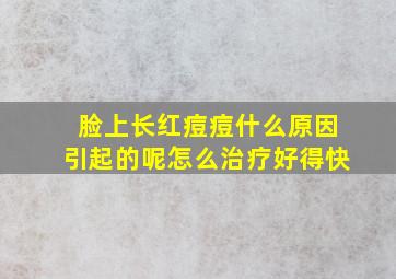 脸上长红痘痘什么原因引起的呢怎么治疗好得快