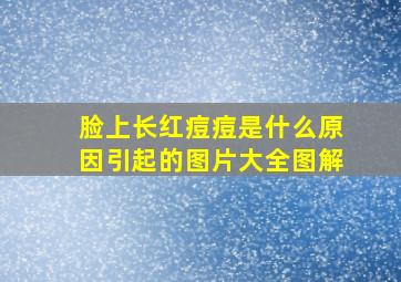 脸上长红痘痘是什么原因引起的图片大全图解