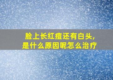 脸上长红痘还有白头,是什么原因呢怎么治疗