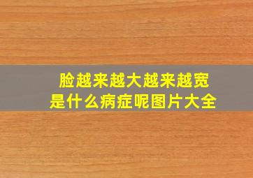 脸越来越大越来越宽是什么病症呢图片大全