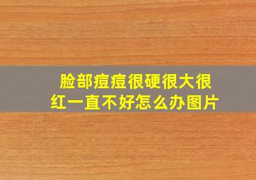 脸部痘痘很硬很大很红一直不好怎么办图片