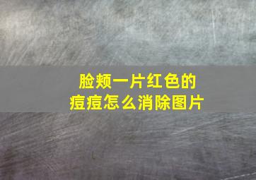 脸颊一片红色的痘痘怎么消除图片