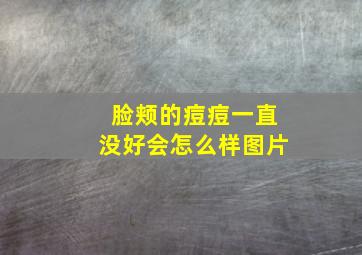 脸颊的痘痘一直没好会怎么样图片