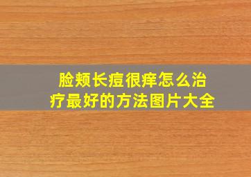 脸颊长痘很痒怎么治疗最好的方法图片大全