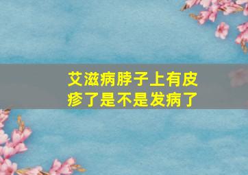 艾滋病脖子上有皮疹了是不是发病了