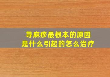 荨麻疹最根本的原因是什么引起的怎么治疗