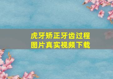 虎牙矫正牙齿过程图片真实视频下载