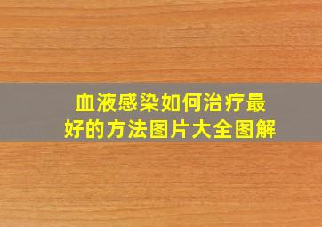 血液感染如何治疗最好的方法图片大全图解