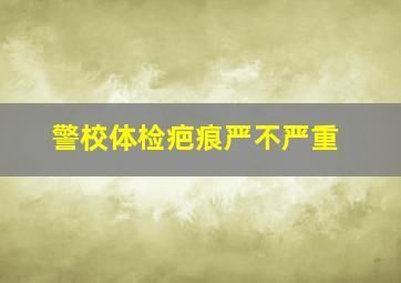 警校体检疤痕严不严重