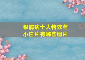 银屑病十大特效药小白片有哪些图片