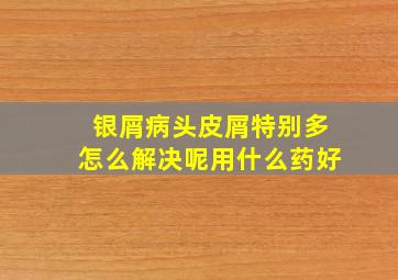 银屑病头皮屑特别多怎么解决呢用什么药好