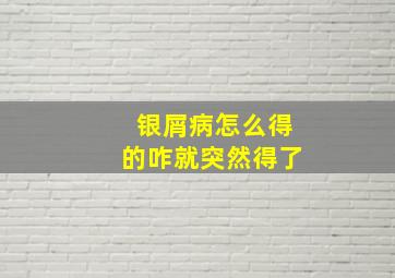 银屑病怎么得的咋就突然得了