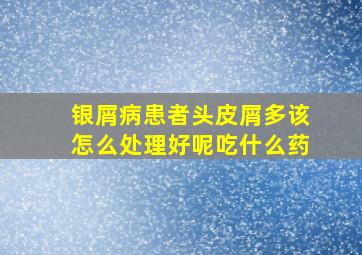 银屑病患者头皮屑多该怎么处理好呢吃什么药