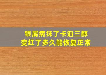 银屑病抹了卡泊三醇变红了多久能恢复正常