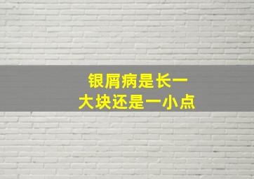 银屑病是长一大块还是一小点