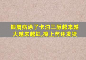 银屑病涂了卡泊三醇越来越大越来越红,擦上药还发烫