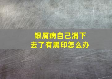 银屑病自己消下去了有黑印怎么办