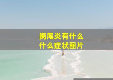 阑尾炎有什么什么症状图片