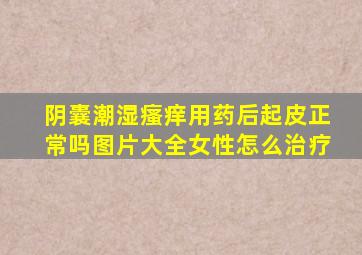 阴囊潮湿瘙痒用药后起皮正常吗图片大全女性怎么治疗