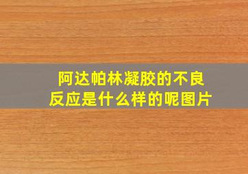 阿达帕林凝胶的不良反应是什么样的呢图片