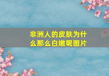 非洲人的皮肤为什么那么白嫩呢图片