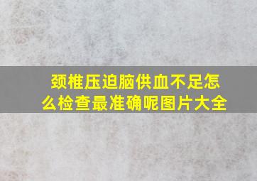 颈椎压迫脑供血不足怎么检查最准确呢图片大全