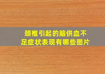 颈椎引起的脑供血不足症状表现有哪些图片