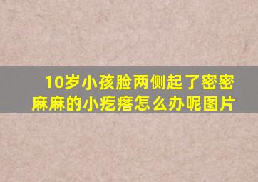 10岁小孩脸两侧起了密密麻麻的小疙瘩怎么办呢图片