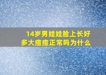 14岁男娃娃脸上长好多大痘痘正常吗为什么