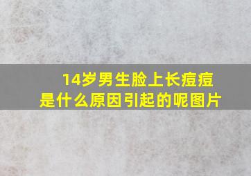 14岁男生脸上长痘痘是什么原因引起的呢图片