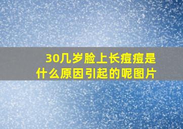 30几岁脸上长痘痘是什么原因引起的呢图片