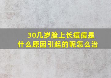 30几岁脸上长痘痘是什么原因引起的呢怎么治