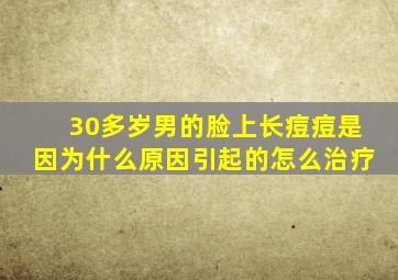 30多岁男的脸上长痘痘是因为什么原因引起的怎么治疗