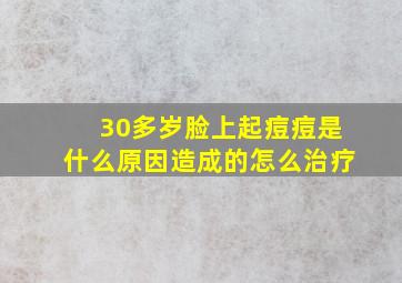 30多岁脸上起痘痘是什么原因造成的怎么治疗