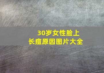 30岁女性脸上长痘原因图片大全