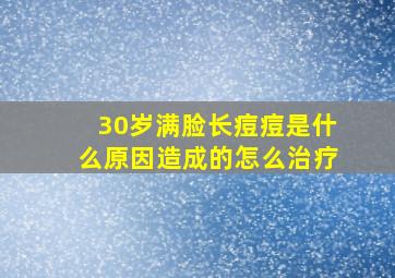 30岁满脸长痘痘是什么原因造成的怎么治疗